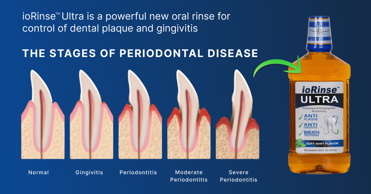 New Research Challenges Traditional Oral Hygiene Practices, Advocates for Molecular Iodine Rinses