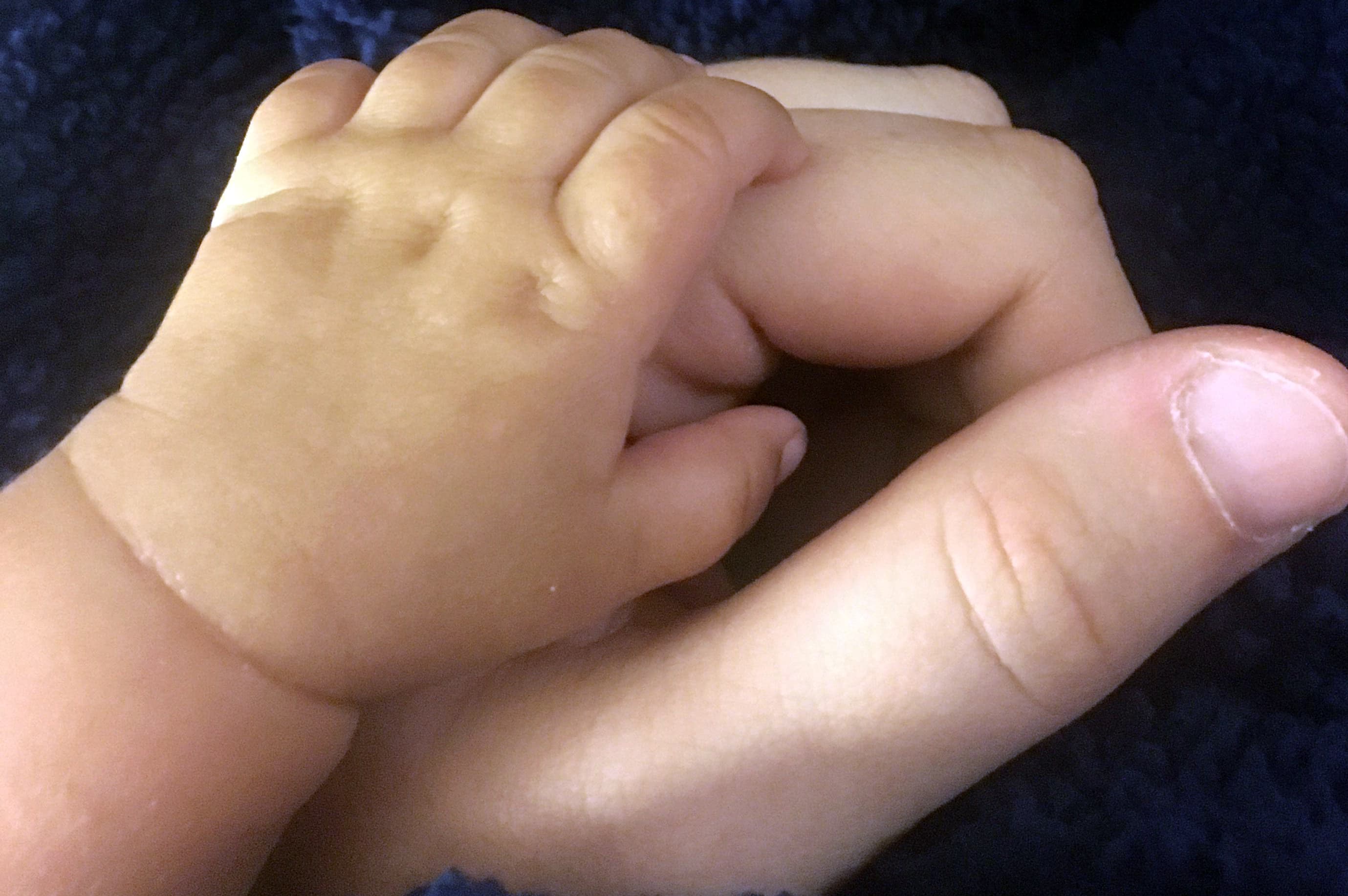 Study Reveals Increased Cancer Risk for Newborns with Heart Defects and Their Mothers