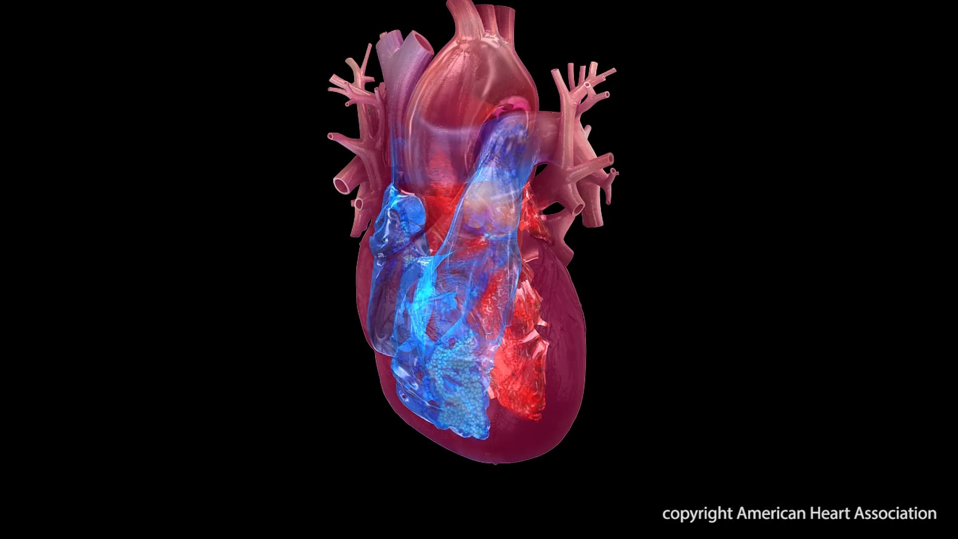 Shift in Heart Disease Deaths Highlights Progress and New Challenges
