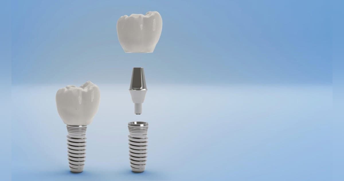 Gunbarrel Dental Center Offers Professional Teeth Whitening Options in Boulder