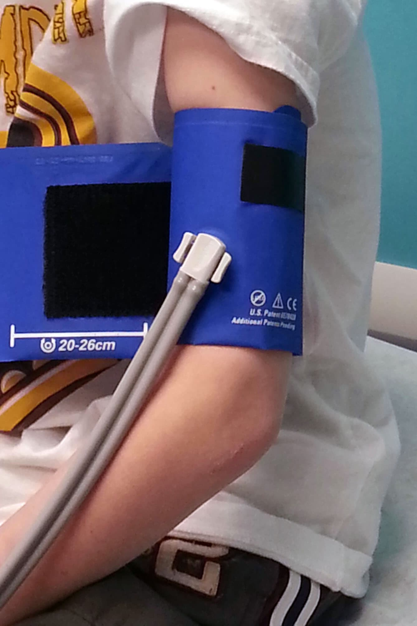 High Blood Pressure Prevalent Among U.S. Adolescents and Young Adults, Studies Reveal